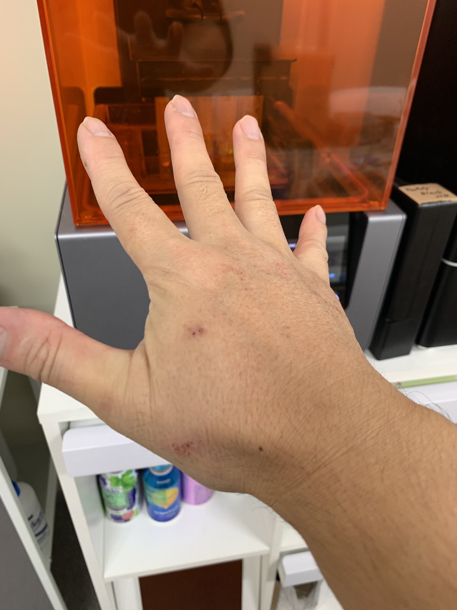 さいめくす 大切な事を言います レジンは素手で触るな 最近レジンが手に付着するとアレルギー反応が出るようになった 触っている頻度が高いのもあるけど 気をつけた方が良い じゃなくてグローブしような 痛いし痒いぞコンチクショー レジン