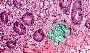 ClinExpPathol's tweet image. Digital #Pathology: Roadmap to the Future of Medical Diagnosis
bit.ly/2FInA0U