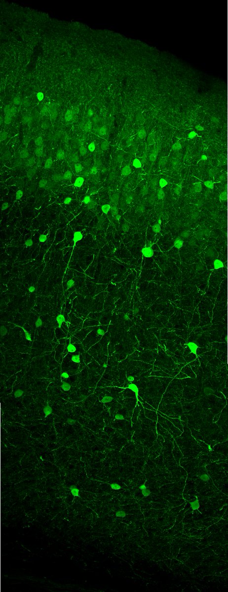 ecutterflower's tweet photo. #calbindin interneurons in the somatosensory cortex (mouse brain)
#science #fluorescence #brain #mouse @MRCHarwell https://t.co/MknQNQkEnz