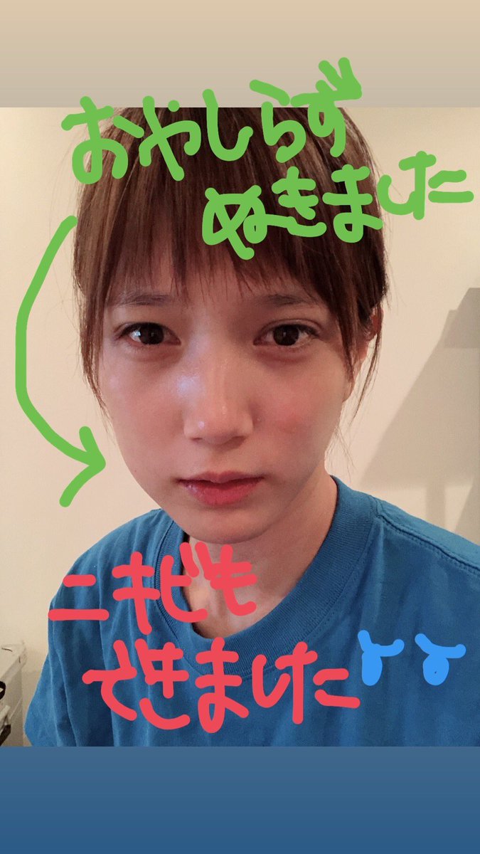Twitter 上的 ほんだ ゆりんこ 抜いたんだばさちゃん 分かるよ腫れるよね でもちょっとほっぺふくらんでるのかわいい すっぴんだし相変わらず半袖だし 笑 わたしも今4本くらい抜いて口の中大改造してるけどやっぱり親知らずがいっっちばん痛かった