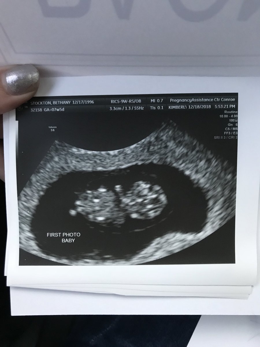 katfish_koska's tweet photo. Ima be a dad🤙🏼 https://t.co/ifLT6NDzCy