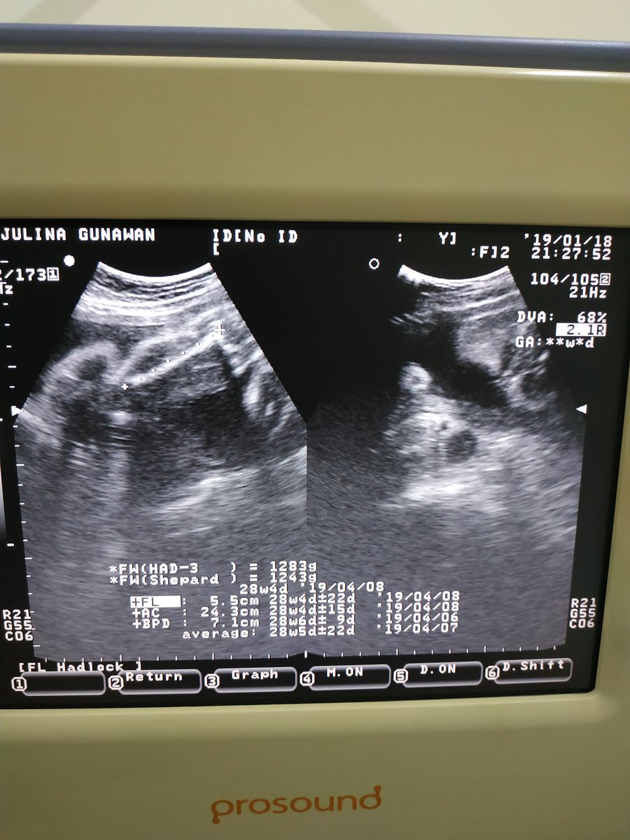 Yayan Abdullah tweet media