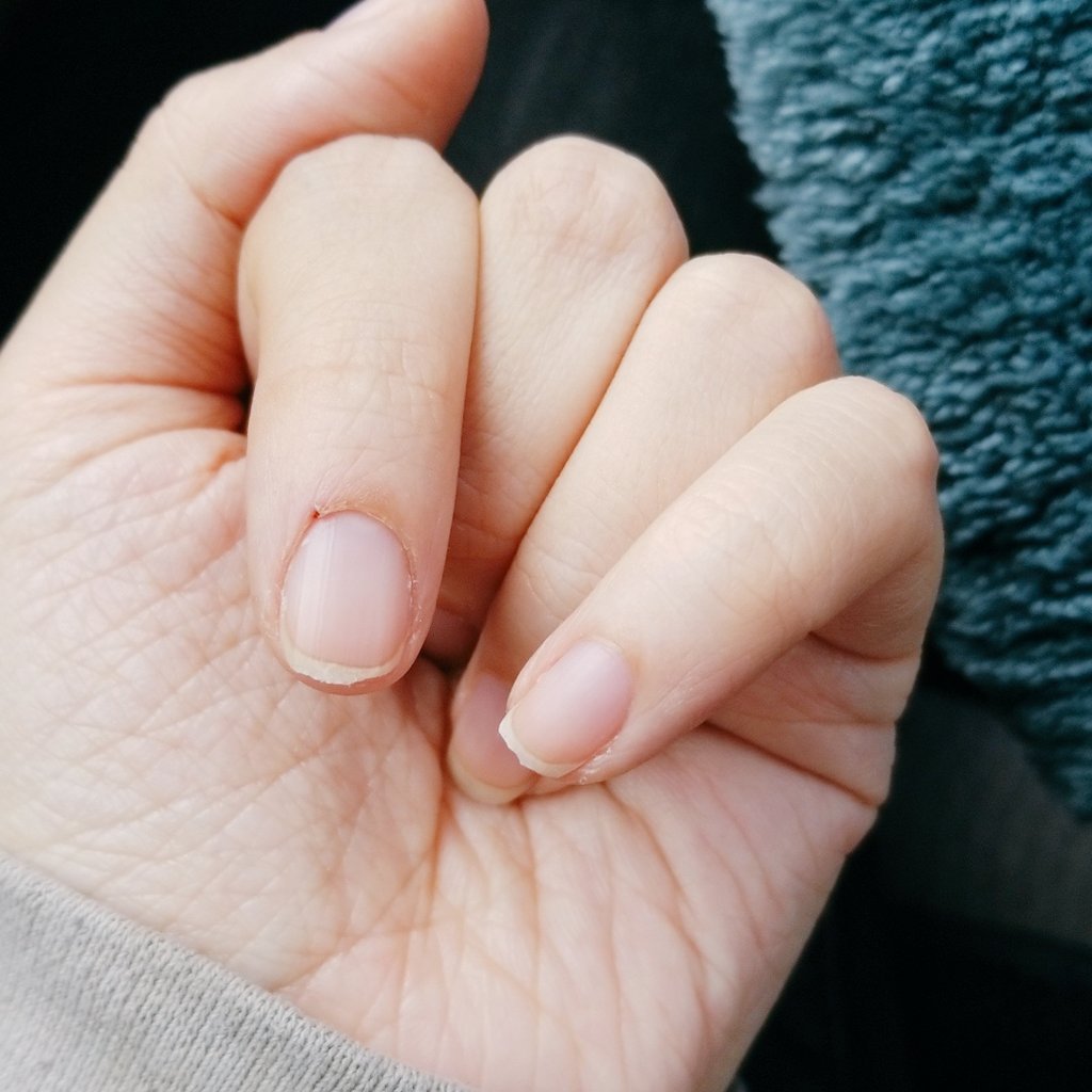 DawnEastpoint's tweet image. Ouch. Leg gave out, broke 2 nails when I caught myself. #disabledproblems