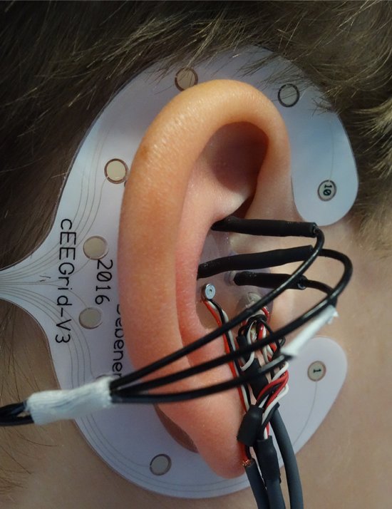 IEEEBrain's tweet photo. ๐ถSay it loud, say it clear, you can listen as well as you hear. ICYMI, this month's @IEEEBrain #BrainInsight #Newsletter has a great piece on listening to the #brain using hearing devices: https://t.co/4arAxpkZZR https://t.co/6X4bfAjmWd
