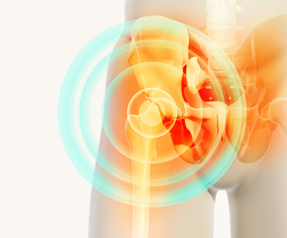 A chondral defect of the #hip is a condition that occurs when there is #articularcartilage damage.  medilink.us/9ia2