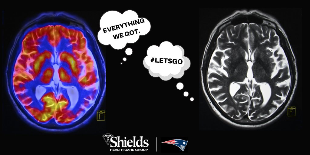 shields_health's tweet photo. At Shields, we can always tell what you're thinking! #AFCChampionship #EverythingWeGot #LetsGo https://t.co/cXyIdpAvZp