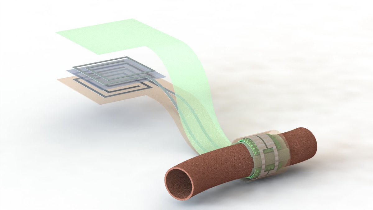 DesignEnginR's tweet photo. Wireless, Battery-Free Sensor Monitors Blood Flow https://t.co/X5MSEN3AAR https://t.co/foTcSsjH4c