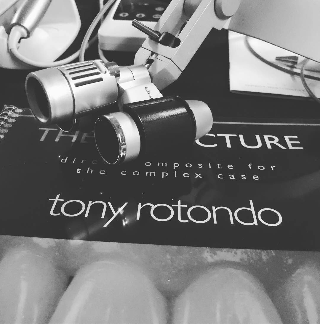 Complex direct composite update @ Tony Rotondo Course #dentistry #dentiatrylife #inspireddentalcare #exeter #exeterdentist #awardwinningdentistry #cosmeticdentistry #veneers #compositeveneers #smiledesign