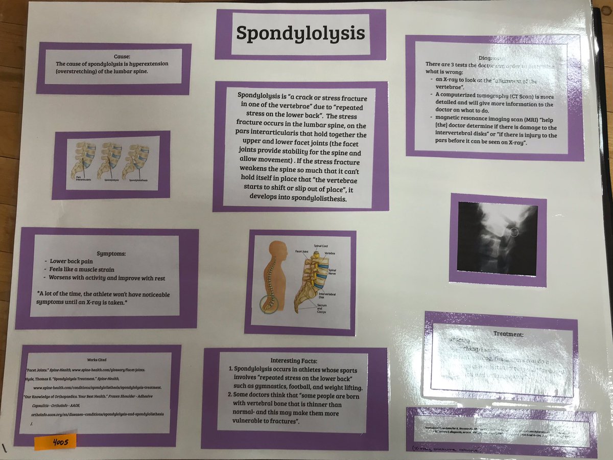 GHATSdotORG's tweet photo. Poster Competition Results #GHATS2019 
Miscellaneous
1. Aubrey Stolle, Tomball Memorial HS
2. Citlalli Lugo, Caney Creek HS
3. Marion Dinn, ClearBrook HS https://t.co/LvYSoXiyxc