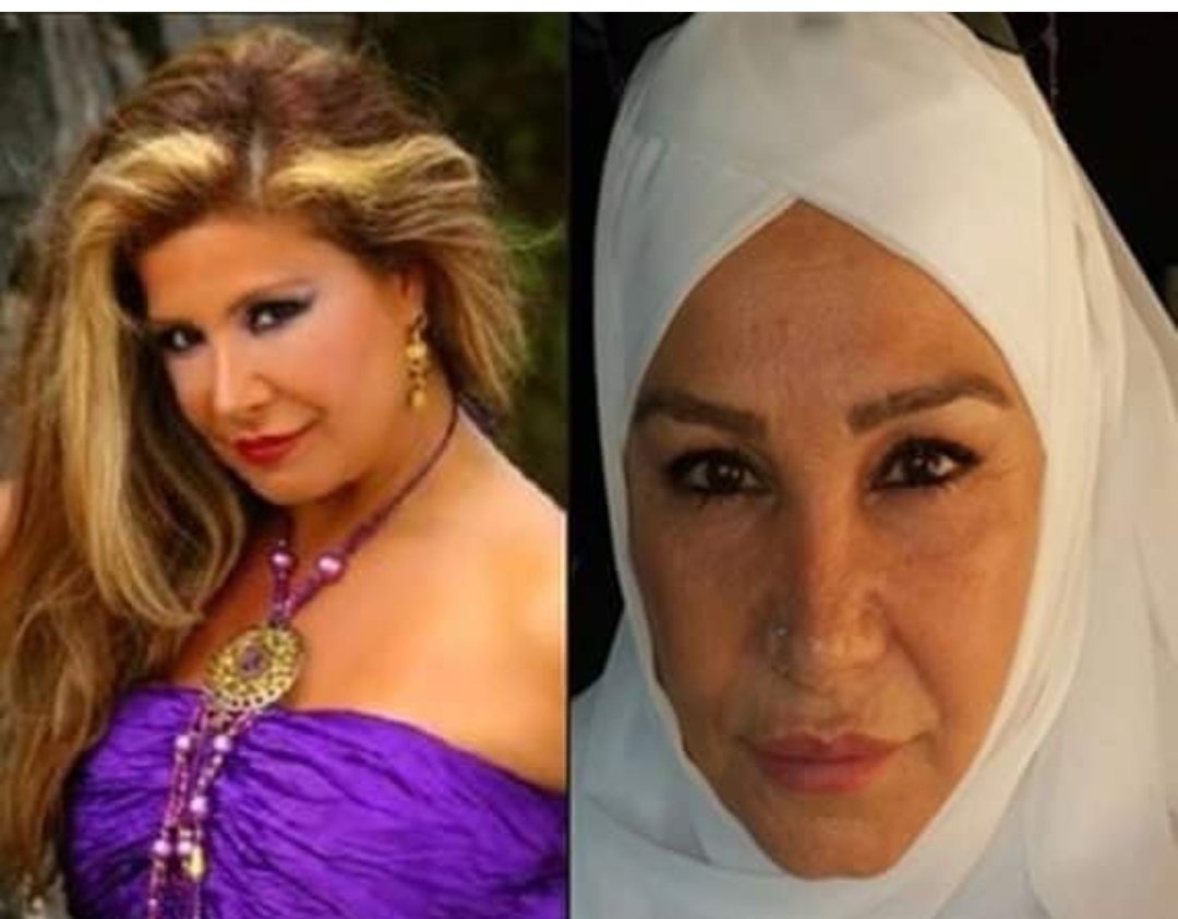 Bize fotodaki gibi rant peşinde koşup kapanan botokslular değil vatan sevdalısı sanatçılar lazım👍👏👏👏👏👏