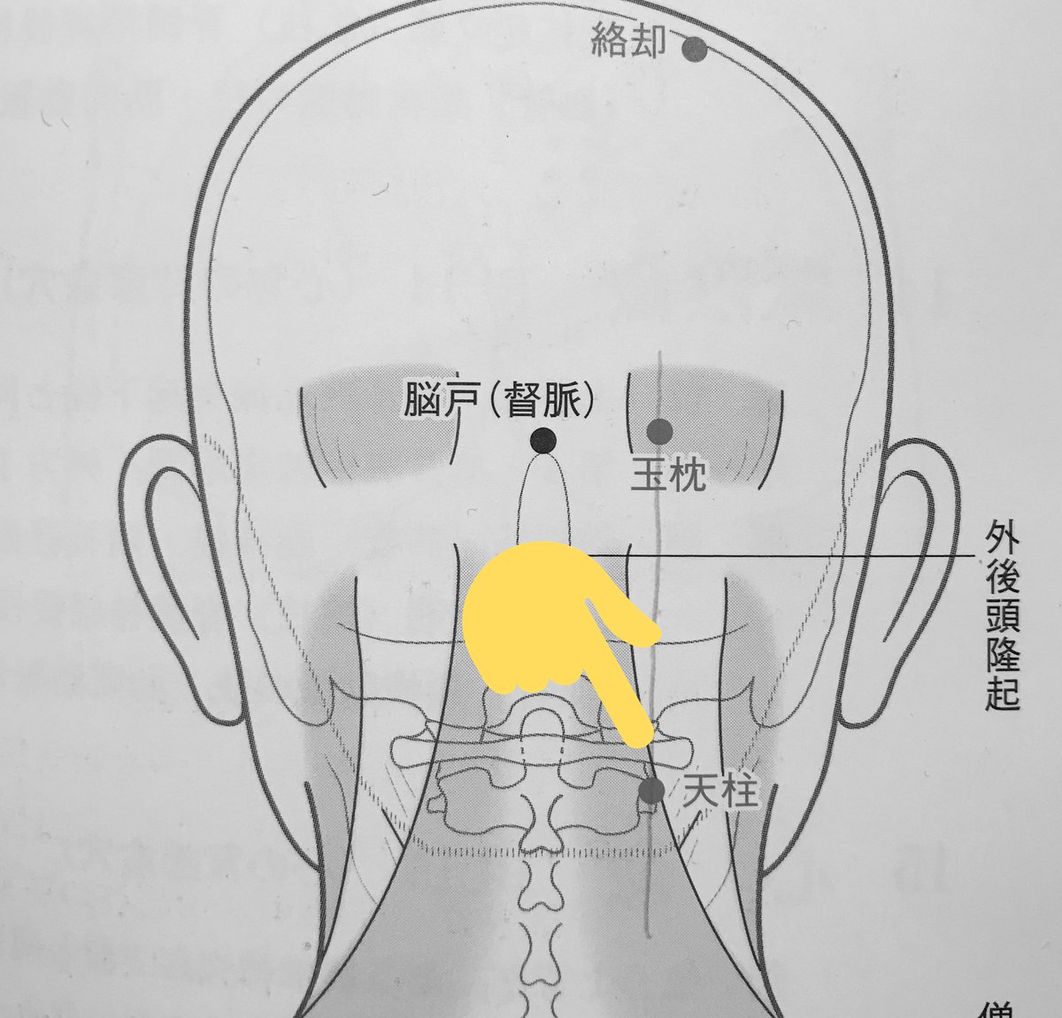 天柱