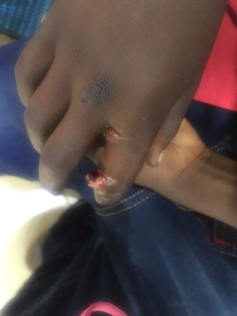 dewamavhinga's tweet photo. Soldiers on rampage in Harare, breaking into people’s homes, beating &amp; arresting occupants, one soldier stepped on the hand of a sleeping 5-year old boy, breaking his fingers. Horrors of the security forces crackdown #ZimbabweShutDown @RalphBlack10 @zimlive @UNGeneva @263Chat https://t.co/zBEUx4b9jX