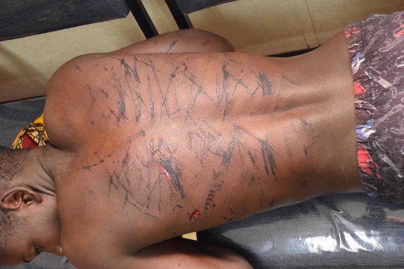 PiersPigou's tweet photo. Zimbabwe's security forces are busy beating .
These teenagers were assaulted last night in Kuwadzana, a high density area near Harare. Many more violations are being reported from across the country,  including rural areas. First reports of rape by soldiers also received. https://t.co/Ev7ELiNDX1