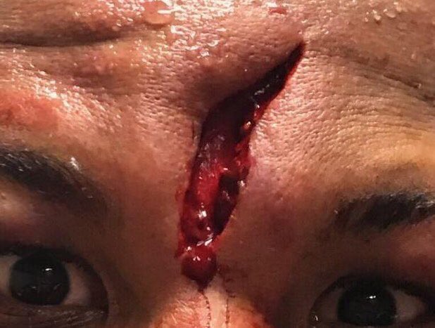 RavennAlexes's tweet image. Just gonna leave these right here. #headbutt