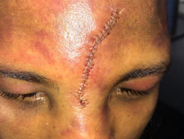 RavennAlexes's tweet image. Just gonna leave these right here. #headbutt