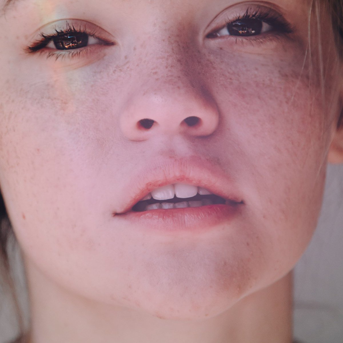 New Look Skin Center Our Elight Ipl Photofacials Help Treat Skin That Has Been Overexposed To Environmental Aggressors Or Those That Suffer From Inherent Skin Problems It Uses Intense Pulsed