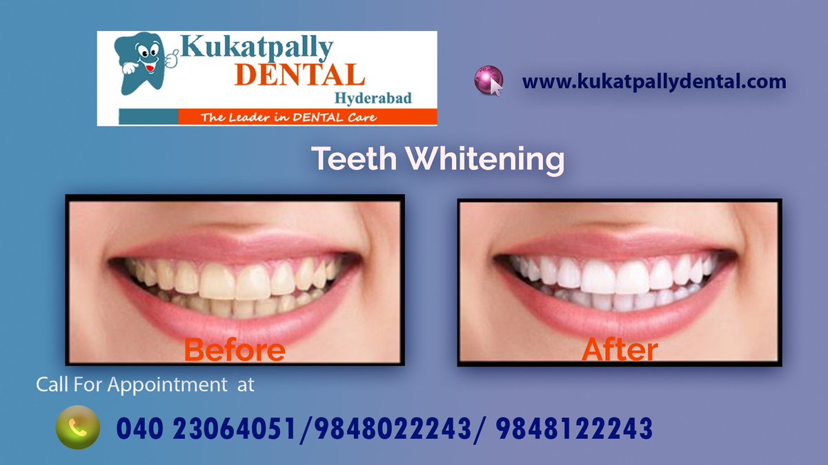 kukatpallydent1's tweet image. The one and only best hospital to get solution for all your Dental Problems is Kukatpally dental Hospital in Kukatpally ,Hyderabad.
To get appointment call at:
040 23064051 / 9848022243, / 9848122243
kukatpallydental.com
#dentalclinic #dentalhoapitalathyderabad #teethwithening