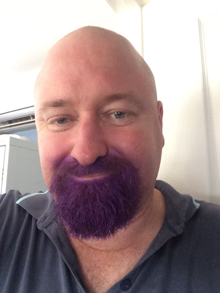 LuckyPhill1607's tweet photo. Today was crazy hair day at my school holiday job....other than looking like a spray painted bowling ball I felt #crazybeard was a better option. Let me know what you think and please RT see how far #purplebeard goes https://t.co/qKNKSJOkyR