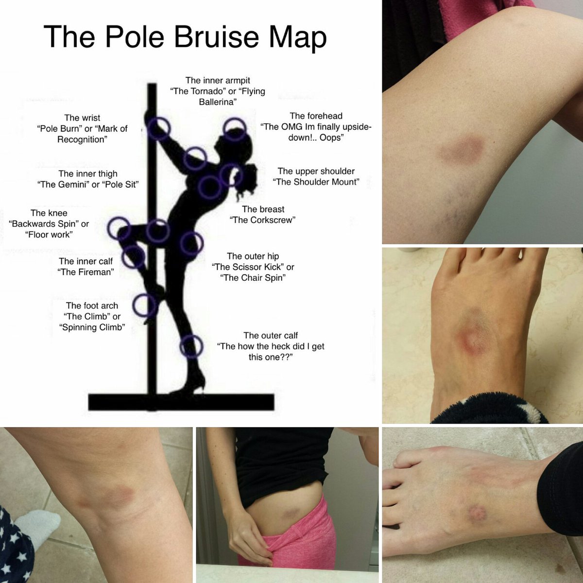 Katie_Fleming's tweet photo. Nearly have collected all the #polebruises! 😵 Whole new level of pain (not to mention they're ugly AF) but #determined to keep going 😬💪 https://t.co/JUV1bzKmTu