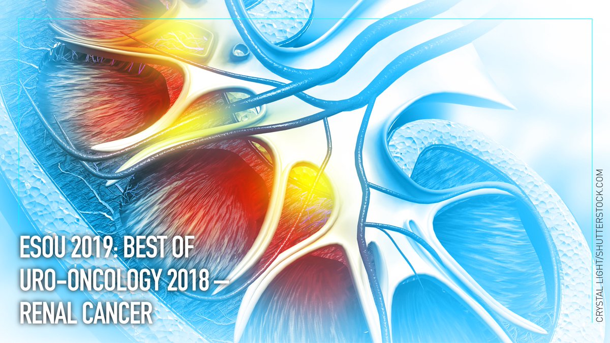 The annual update on impactful papers in the field of renal cancer was presented at #ESOU19 in Prague over the weekend. <a href="/urotoday/">UroToday.com</a> presents a quick summary here:
goo.gl/CDXW6K