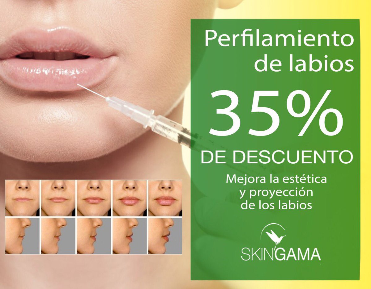 SkinGamaMedic's tweet photo. Hoy es el gran día, para lucir sexy, armonios@, joven y guap@s #labiossexys #hombres #HOMBRESBUENOS #Mujeres #MujeresDivinas #Coapa #medicinaestetica #BuenosDiasATodos #lunes #saludesbelleza https://t.co/QdK5xpNwb4
