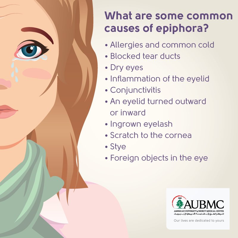AUBMC_Official's tweet image. #Causes of #Epiphora