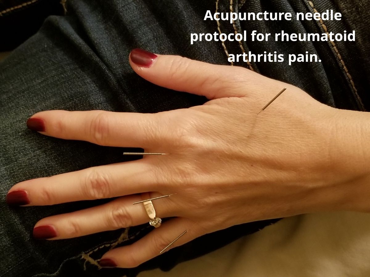 New blog! Can Traditional Acupuncture work on Modern day stress? - mailchi.mp/3b8a9477f770/y… #acupunctureforstress #chinesemedicine #phoenixacupuncture #drphilzair #livingpurechiropractic #naturalcures