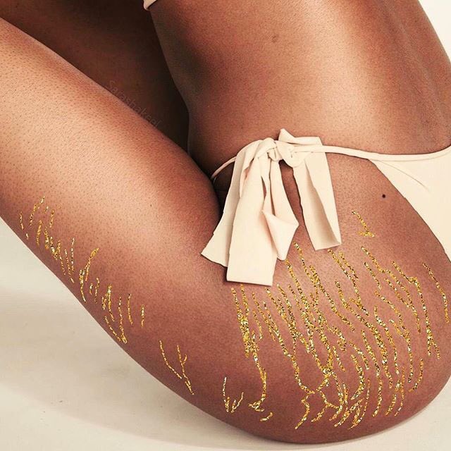axngeI's tweet photo. e essa artista que transformou estrias em glitter p inspirar as mulheres a se amarem?????? MANO QUE FODA JEJEJENDNRNNS https://t.co/TdOLuAPoPK