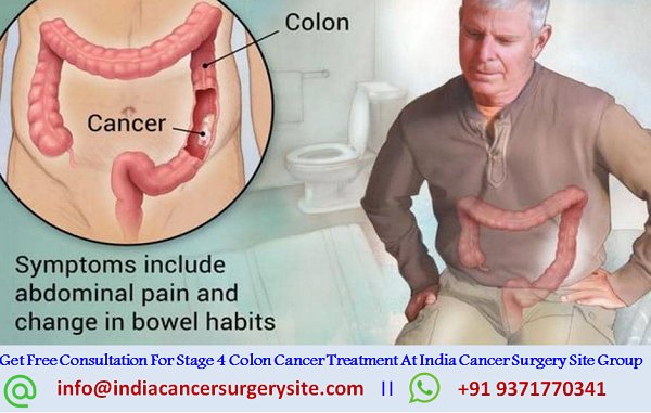 To Get Free Consultation For #stage4ColonCancer From Our #BestColonCancersurgeon you Can Call at : +91 9371770341.
Visit Here : bit.ly/2R8GqjT