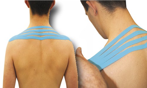 Temtex_Es's tweet photo. Presentamos una Nueva Técnica Obtenida del libro "Vendaje Neuromuscular - Kinesiotape en Fisioterapia para el Trapecio Superior #vendaje #Temtex #salud https://t.co/PnuBxnZMIA https://t.co/XE09pONGQE