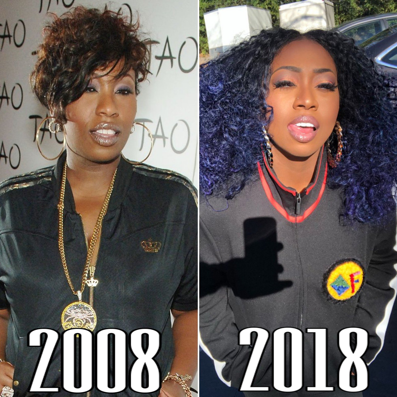 missy elliott plastic surgery Image 9