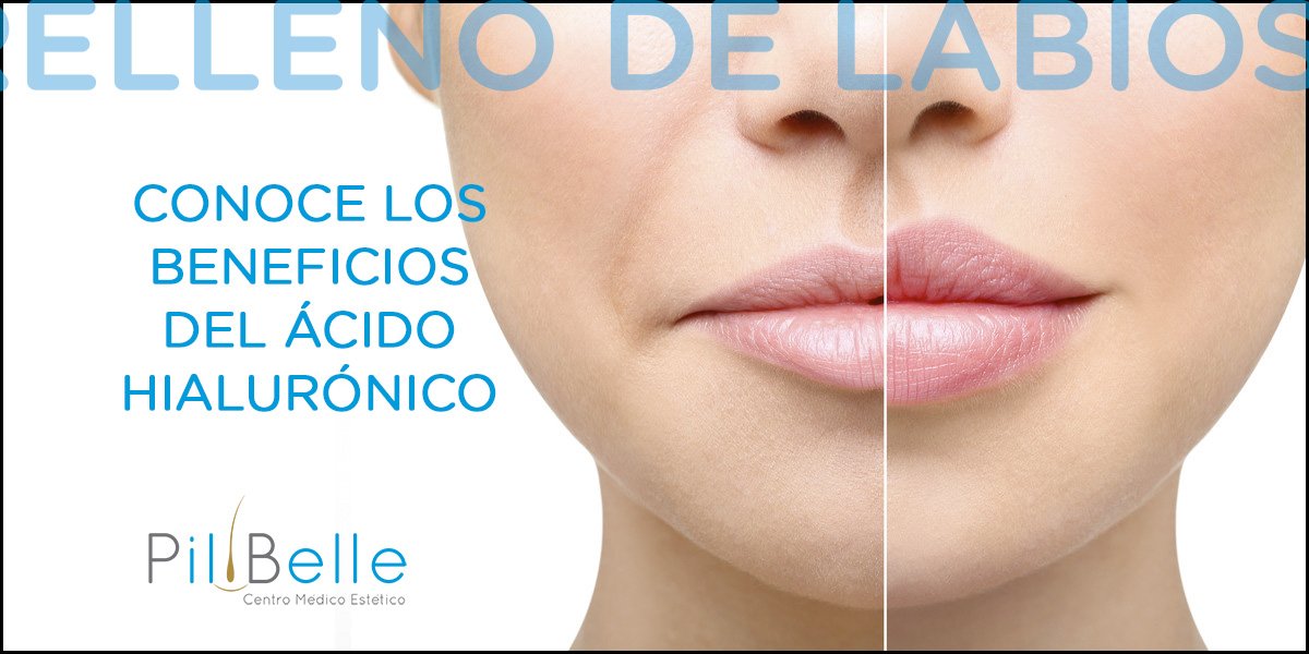 PilBelle's tweet photo. ¿A quién no le gusta lucir una sonrisa perfecta y unos labios con  volumen? ¿Aún no conoces los beneficios del  #ÁcidoHialurónico? ¡INFÓRMATE! 👉 957 491 696

#RellenoDeLabios #CentroPilbelle #ccelarcangel @ccelarcangel #labios #volumenlabios https://t.co/0psGedxjzL