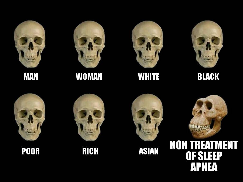 gutter2glory4u's tweet image. Sleep apnea doesn't care who you are, race, sex, or religion. But whe. Not treated you will stand out and look weird. Just saying proof right here. Like &amp;amp; SHARE.  #cpap #homesleepstudy #sleepapnea #sleep #snoring #sleepapneasymptoms #sleepapneatreatment