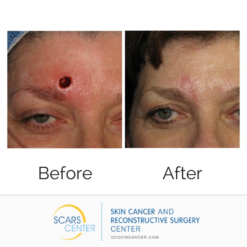 SCARSCenter's tweet image. Get your yearly #skincheck done at the beginning of the year so you're good to go until next year! We've got #2020 vision because that's when we'll be seeing you next: (949) 719-1800