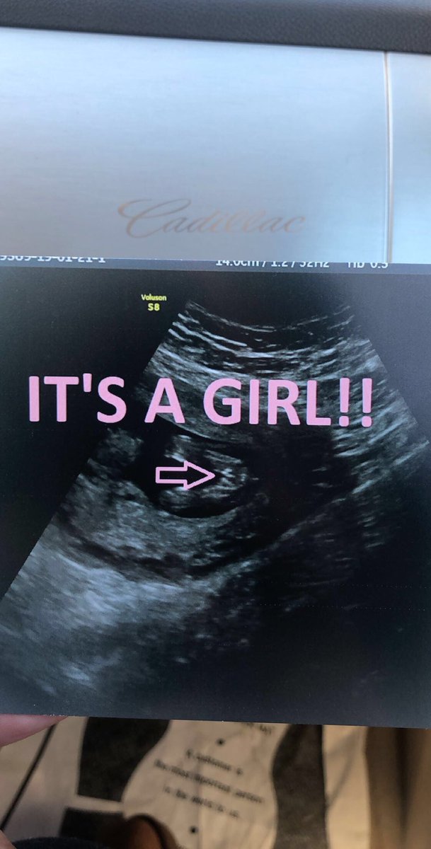lashaaaae's tweet photo. Baby #2, got my boy &amp; girl,... I’m complete 💕 #DDST👦🏻 #EMT🎀👧🏻 https://t.co/5ZW6kdvM3b