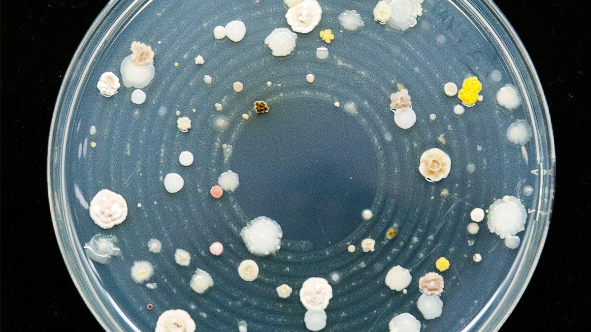 Indigoag's tweet photo. Living inside ordinary looking crops are entire universes of microbes. Pictured are a few that may be found in one plant - each differently shaped or colored colony is a single species.
#IndigoScience #MicrobiomeMonday #microbes #microbiology https://t.co/adoeAXaN0L