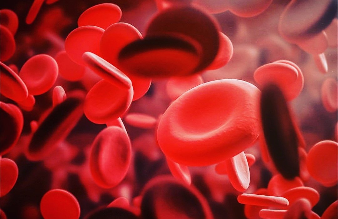 Rare haemophilia revealed after bris
A baby boy born in Cape Town is critically ill with haemophilia, which came to light when he did not stop bleeding after his Brit Milah.
For more info go to sajr.co.za/latest
#medicine #rare #RareDiseases
#baby