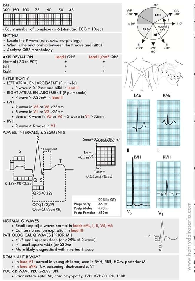 PeroneFrancesco's tweet image. #ecg #ecgfirst #cardiotwitter #cardio