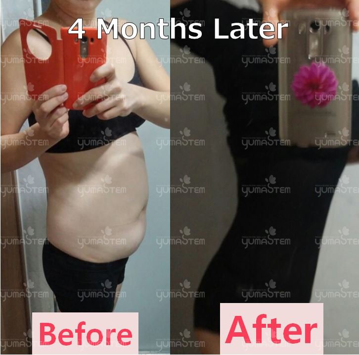 上半身脂肪 Twitter Search Twitter