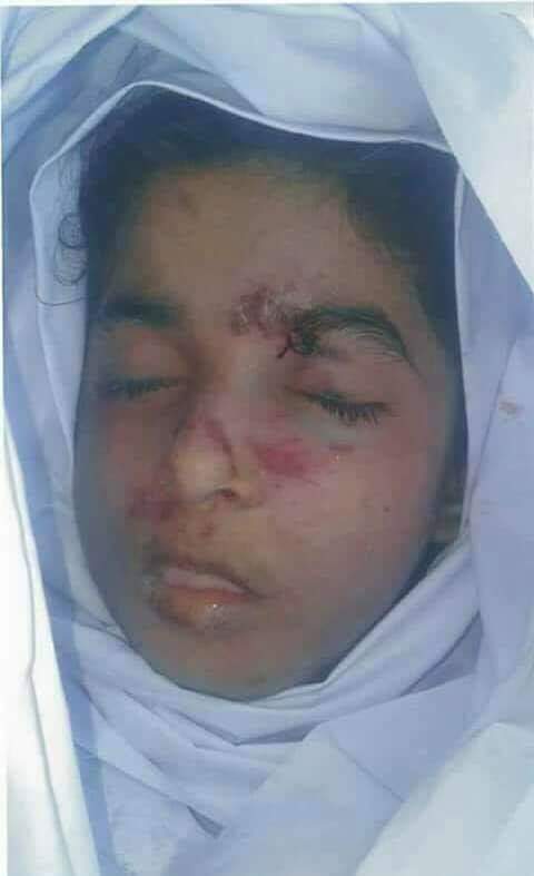 12 year old girl kidnapped, raped to death in Mansehra, police didn't take any action because family is poor.
#ShareToHelp