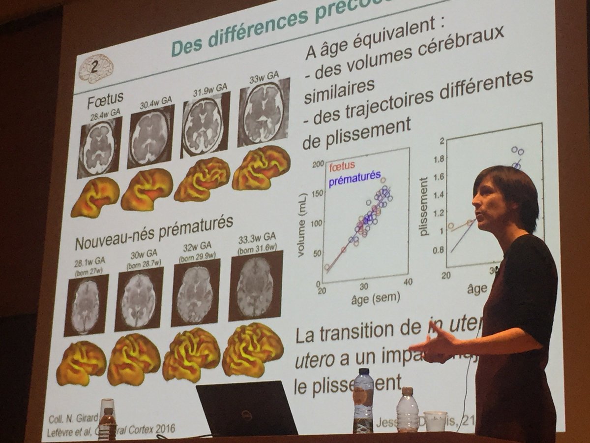 StanDehaene's tweet photo. La remarquable synthèse de Jessica Dubois sur "L'organisation précoce du cerveau du nourrisson", fruit de plus de 10 ans de recherches à NeuroSpin, est en ligne.
https://t.co/jiXHPtvEA2 https://t.co/6TYffrI1z8