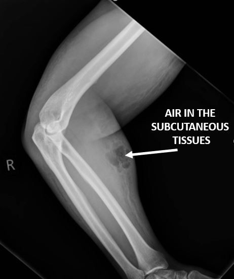 Doctor_V's tweet image. .@Skepticscalpel strikes again on @physicianswkly — Odd medical stories. The third one is jaw-dropping bit.ly/2DsqPI0