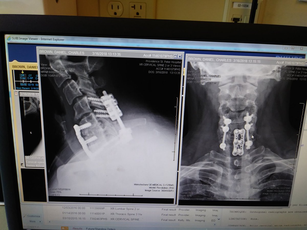 DanielCBrown3's tweet photo. @DonaldJTrumpJr @realDonaldTrump I'm a non combat veteran a Christian a NRA member and most of all born and bread AMERICAN. I need my President to step in and pardon my record so I can get back to work and support my family. I haven't driven in 12 years I beat epilepsy  don't take medication https://t.co/KLyf5nGqNJ