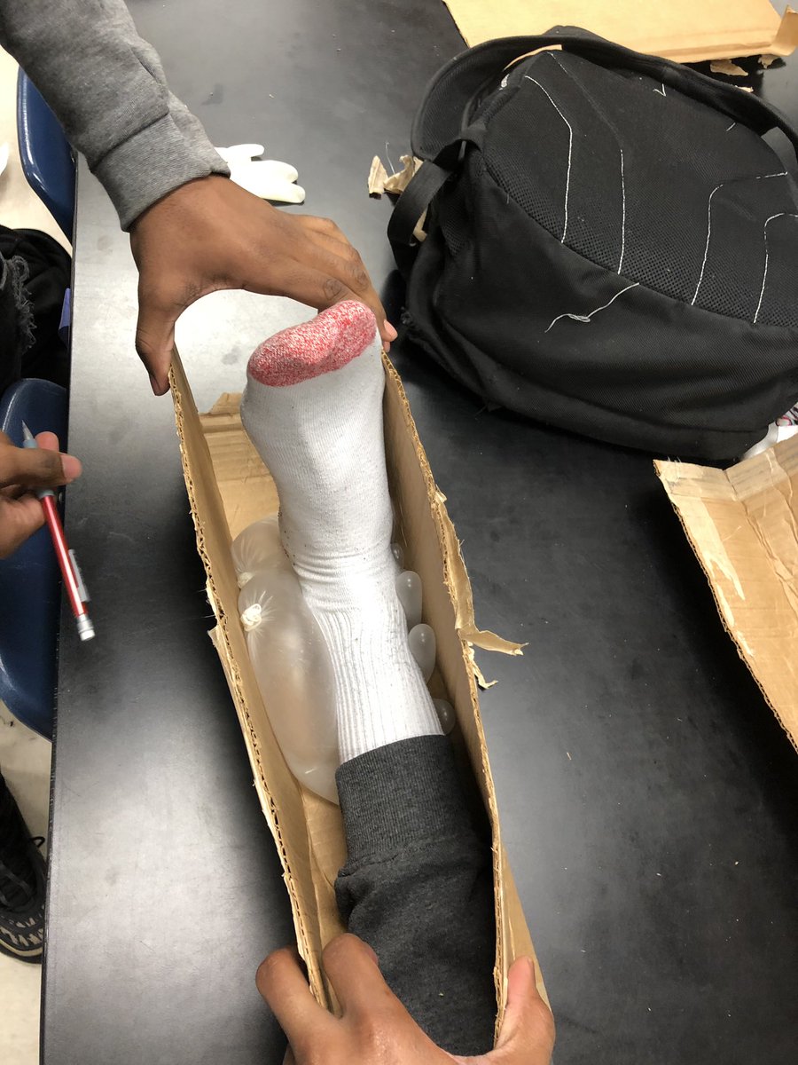 APSSportsMed's tweet image. 🚨 If an athlete needs their ankle immobilized due to a traumatic injury and you don’t have a splint...what do you do? Our students can help! #MakeOne