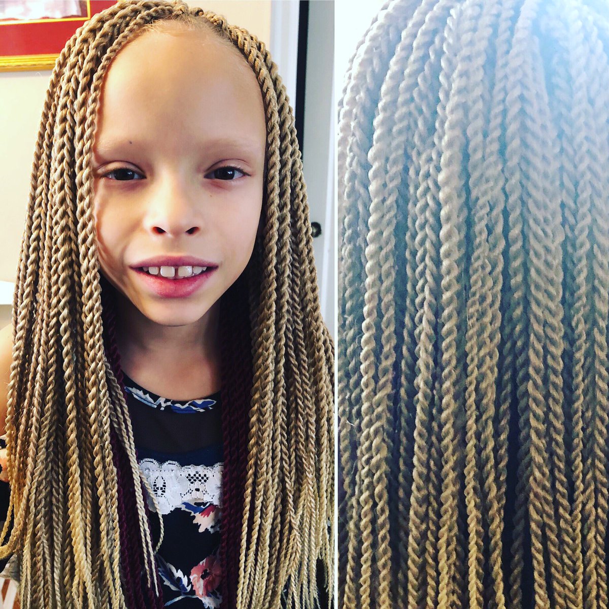 Rachel Anne Dolezal On Twitter Senegalese Twists I Did For A