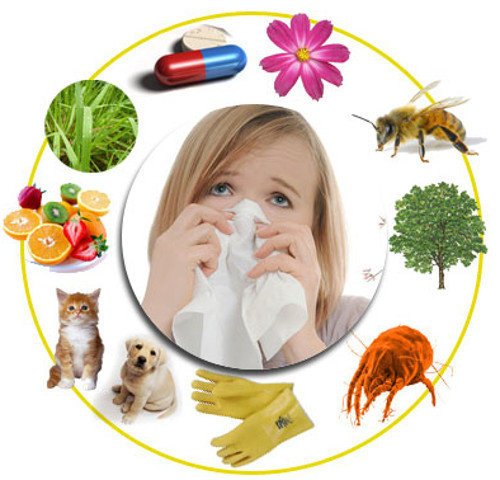 AndGzDz's tweet photo. Allergy https://t.co/mAsfHD46xW https://t.co/g9pH2D2hyj
