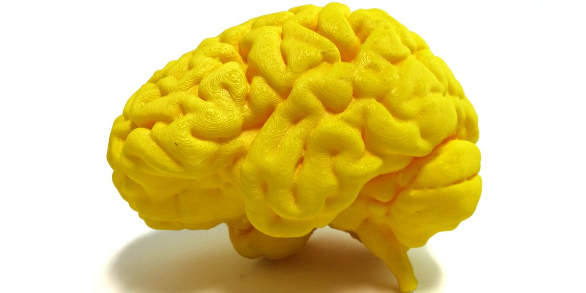 CatchTheBaby's tweet image. "Scientific serendipity" identifies link between type of RNA and #Autism - Scope buff.ly/2R5RJJv #longnoncodingRNA #IncRNAs

@VahabzadehMD