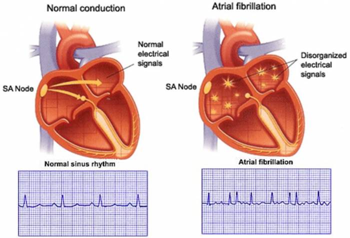 CardiovascTher's tweet photo. Cardiovascular Therapy Open Access                       

Submit your Manuscript at :- cardiotherap@healthjournals.org https://t.co/rB928LBgxl