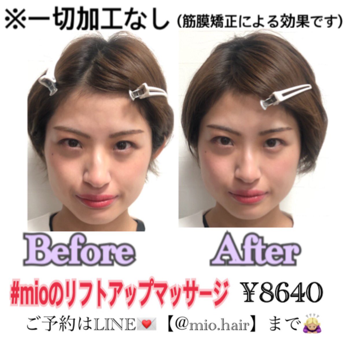 Mioのリフトアップマッサージ