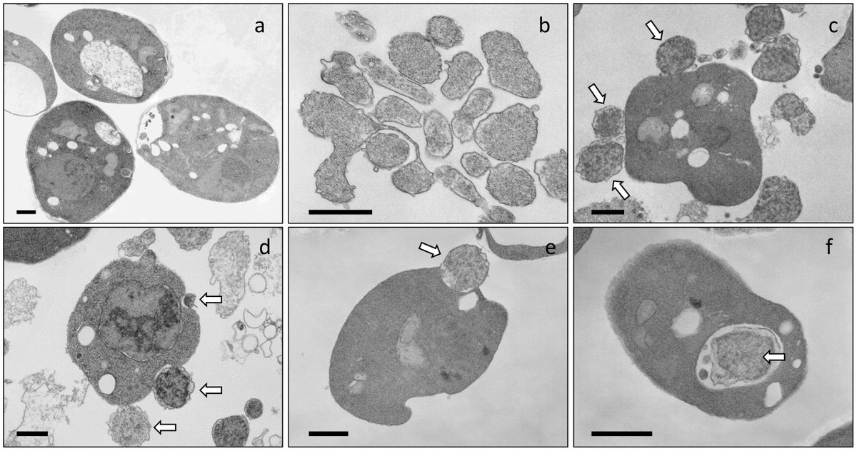 Dr. Karas latest publication from his tenure @JCVenterInst The most efficient way to move whole bacterial genomes to yeast.  It could also lead to the development of synthetic organelles. #syntheticcells 
pubs.acs.org/doi/10.1021/ac…